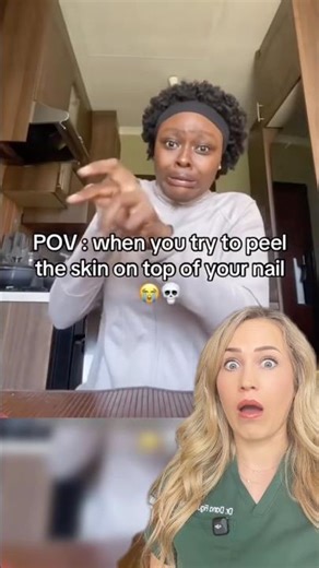 Doctor reacts: extreme hangnail!