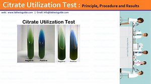 Citrate Utilization Test | Lab Tests Guide