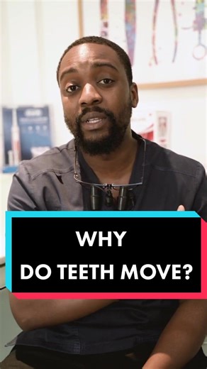 Why Do Teeth Move? Understanding the Causes and Solutions