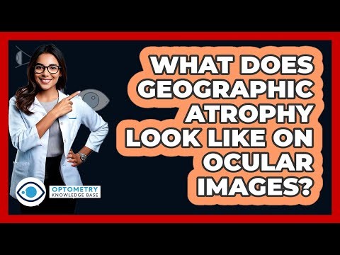 What Does Geographic Atrophy Look Like On Ocular Images? - Optometry Knowledge Base