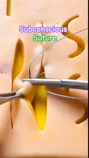 Subconscious Suture • Nursing Student | Hospital Duty | #doctor #nurseing #hospital #shorts #viral