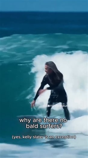 Carnivore Aurelius © on Instagram: "it’s insane how many guys are losing their hair in their 20s today. this is not normal. studies show that hair is a reflection of your overall metabolism. one study talks bout hair loss as a harbinger of health morbidities to come...an early reflection of stress and a declining metabolism. meaning if you’re losing your hair it’s time to stop using a bandaid solution and start getting to the root. even if it doesn’t fix your hair, it will protect against the ot