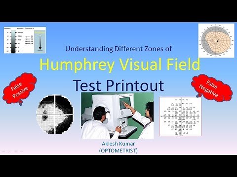 Understanding different zones of Humphrey Visual Field test printout