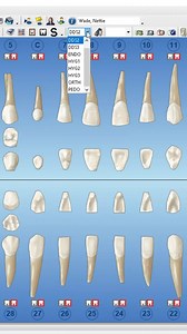 Here are a few other tips on the Dentrix Patient Chart taken from our Dentrix Mastery Tracks courses. To learn more about our offered tracks, visit the resource center on our website: https://www.dentrix.com/products/dentrix/resources #dentist #dentistry #dentalofficemanager #dentrix #dentalstudent | Dentrix