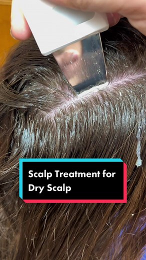 Effective Scalp Treatment for Dry Skin Removal