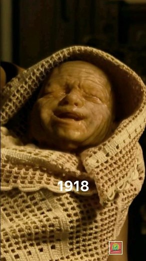 The Man Who Was Born Old: Tragic Life of Benjamin Button #Shorts