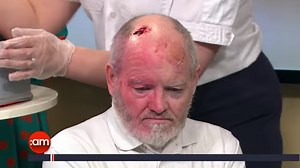 1.3K views · 24 reactions | Do you know how to treat a head injury?...