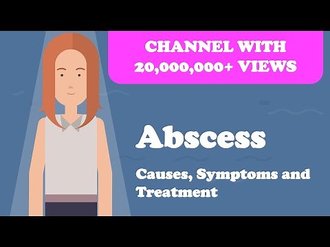 Abscess - Causes, Symptoms and Treatment