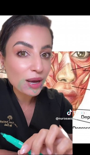 Botox Injection Depth: Why It Matters for Your Smile