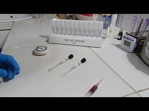 Understanding ESR Blood Test Results: or Decoding Erythrocyte Sedimentation Rate.