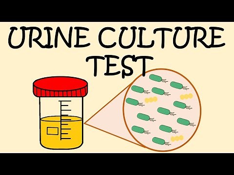 URINE CULTURE TEST - HOW TO COLLECT URINE SAMPLE