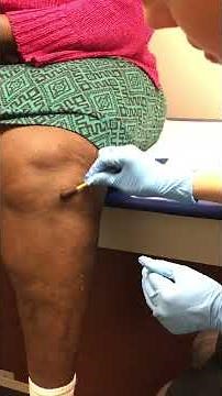 Knee Injection 3