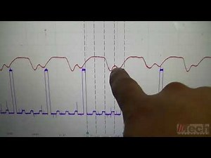 Head gasket testing with a scope