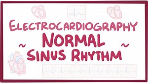 ECG normal sinus rhythm: Video, Causes, & Meaning | Osmosis