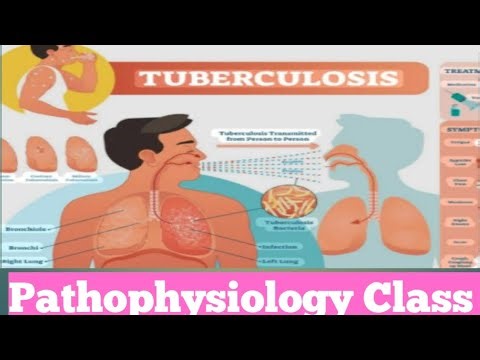 #Tuberculosis # definition, Causes and symptoms treatment and medicament of tuberculosis class #