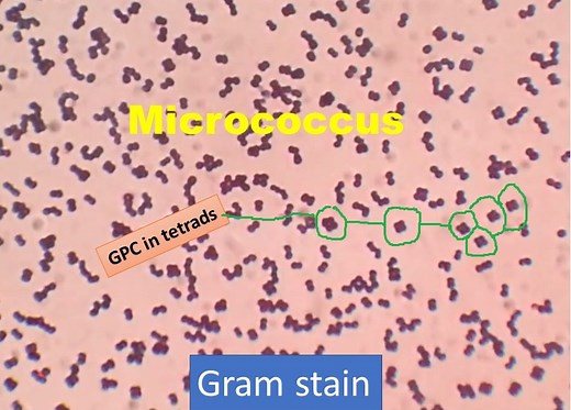 Micrococcus gram stain: Introduction, Principle, Procedure and Result Inter