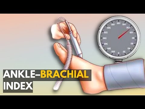Ankle–Brachial Index: Everything You Need to Know