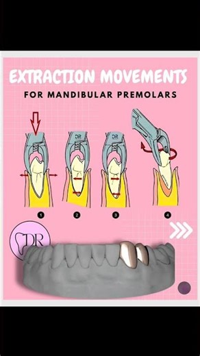Extraction Movements for Mandibular Teeth | Step-by-Step Dental Guide