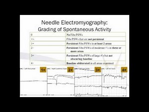 Electrodiagnostic Testing