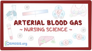 Arterial blood gas (ABG) - Overview: Nursing: Video & Causes | Osmosis