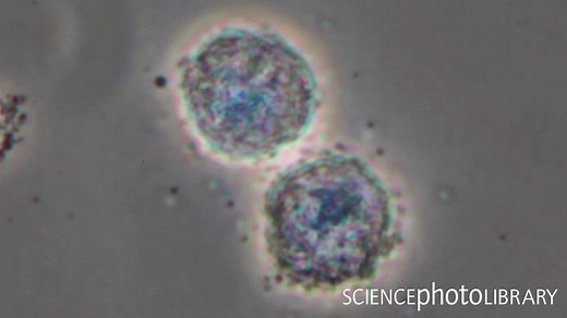 Mast cells are a type of white blood cell that are found in connective tissue. This light microscopy footage shows the degranulation of mast cells, the process by which they release chemicals when activated. Credit: Timelapse Vision Inc / Science Photo Library http://bit.ly/36s4Dda #biology #immunology #medicine | Science Photo Library