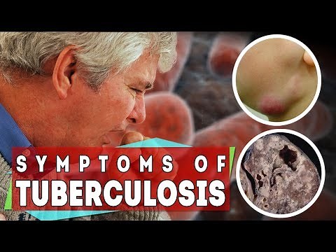 What is tuberculosis - symptoms of TB in all types and stages?