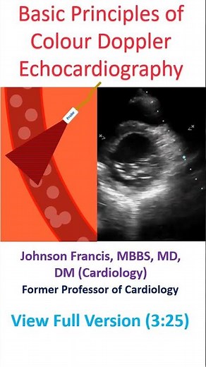 Basic Principles of Colour Doppler Echocardiography
