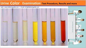 Urine Color, Classifications, Result Interpretations | Lab Tests Guide