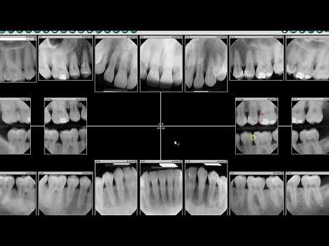 DEXIS™ Imaging Suite - Patient Screen Overview
