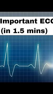 10 Important ECGs (in 1.5 mins) #cardiology #ecg #ekg