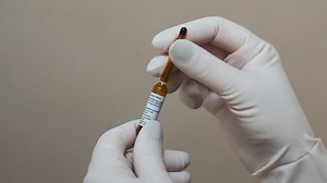 Tuberculosis history and treatment