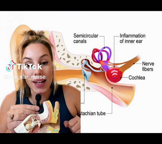 The Ear Nurse on TikTok