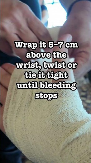 Hand Bandaging – Tourniquet Technique