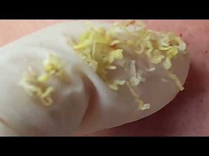 Make Your Day Satisfying with THUY TRUONG SPA New Videos #498