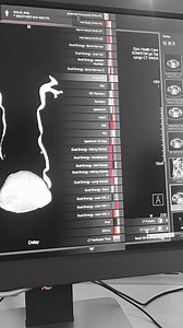 1.6K views · 48 reactions | CT Urogram 3D images | CT Scan and MRI study | Facebook