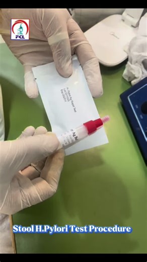 Stool H. Pylori Test Procedure Explained