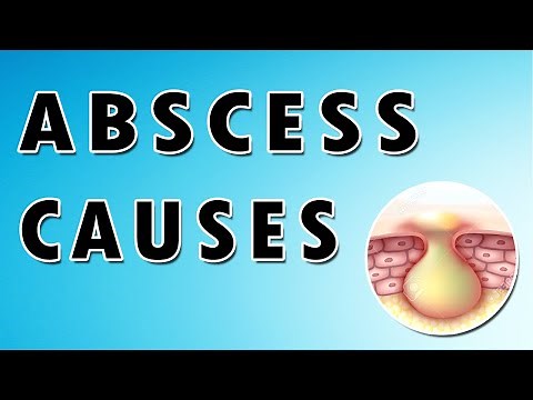 Abscess Symptoms, Treatment, and Causes