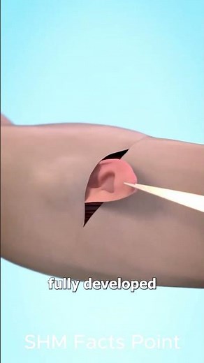 Intricate Ear Surgery Explained: Advanced Otologic Procedures in High Detail ! shortsfeed #shorts