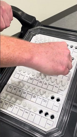 Allergy scratch test explained | Ohio State Medical Center