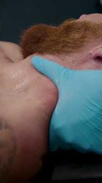 Release Your SCM Muscle for Instant Relief! #shorts