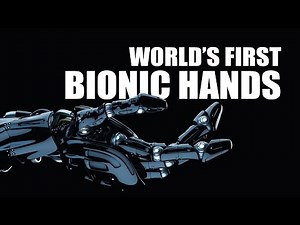 World's First Bionic Hands a Success! - The Know