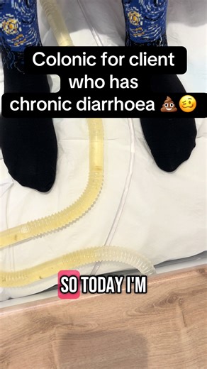 Colonic Hydrotherapy for Chronic Diarrhoea Support