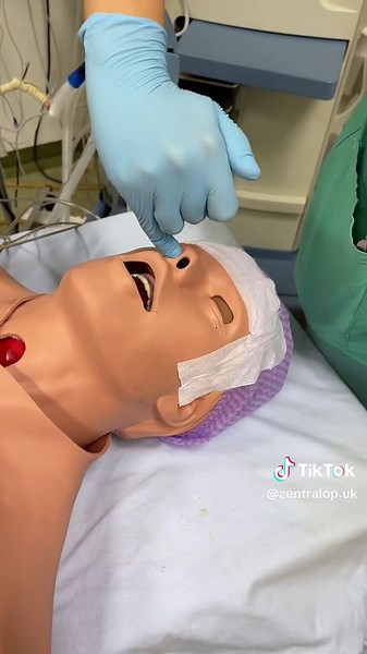 Nasal Intubation Procedure Explained | Anesthesia, Intensive Care & Medical Techniques