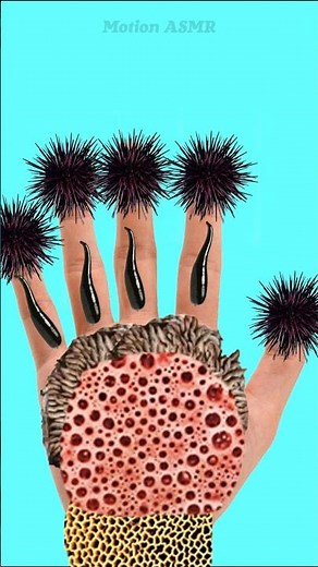 ASMR Animation Treatment Infected Hand Cleaning | 2D ASMR #asmr #satisfying #shorts #healthyhands