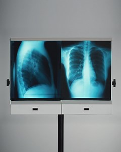 747 reactions · 18 comments | Meta’s open source AI, Llama, is free – enabling Zauron Labs to build an AI tool that’s like a spellchecker for radiologists. | Meta | Facebook