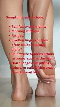 Psoriatic Arthritis Explained.