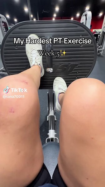 Laughing because you can literally see my leg shaking in the video. This is the leg press machine with the lowest weight setting and it starts at 35 lbs. I’m experiencing a lot of pain in the front of my knee whenever I push to extend my leg and I don’t know if I should be working through that or if I should be backing off?? #acl #pt #aclrecovery #physicaltherapy #fyp