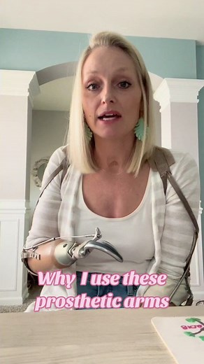 Why I Prefer Hook Prosthetic Arms Over Hands