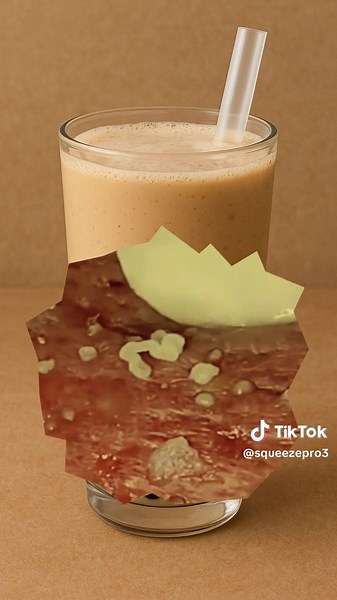 #squeeze #squeezeyuk