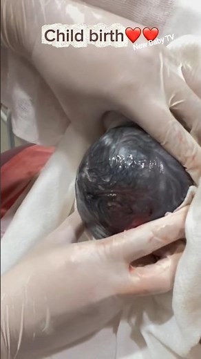 "Child Birth Miracle 😍 | Newborn Baby’s First Cry 💖 | Real Life Child Delivery Video" #baby #doctor